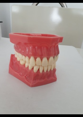  Fantom Model çene