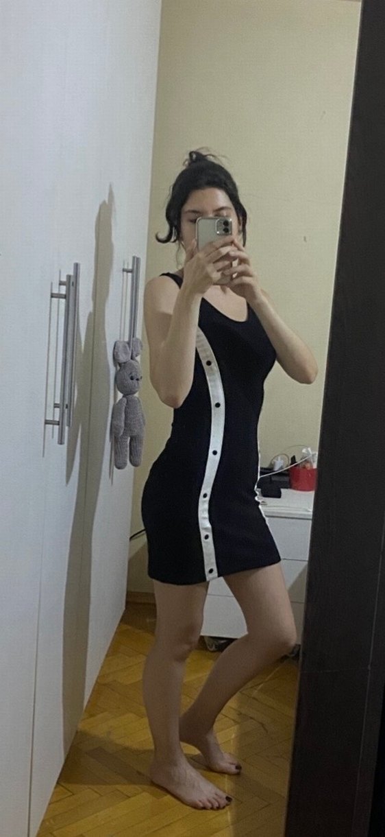 Siyah Düğmeli Mini Elbise - Görsel 3