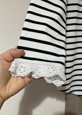 Dantel Detaylı Çizgili Hamile Bluzu - Görsel 2