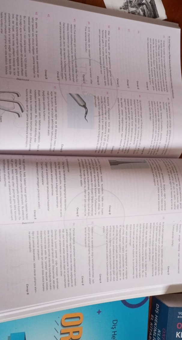 DUS Periodontoloji Soru Bankası Tamamı Çözümlü - Görsel 3