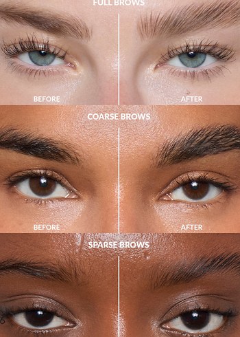 Refy-Kaş Sabitleyici - Görsel 3