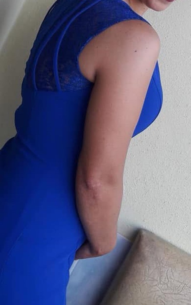 Mavi V Yakalı Kolsuz Midi Elbise - Görsel 2