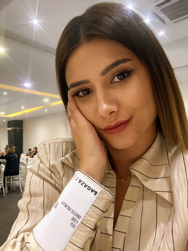 Çizgili Mini Kadın elbise sagaza - Görsel 2