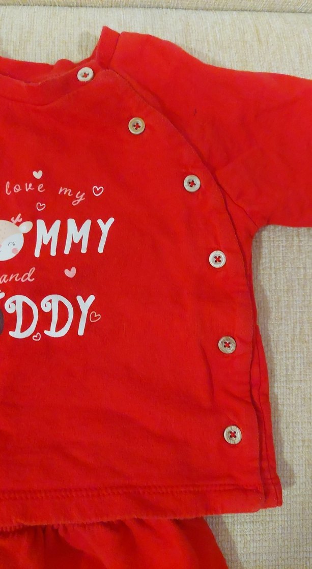 Kırmızı Bebek Takımı, Uzun Kollu, Düğmeli - Görsel 3