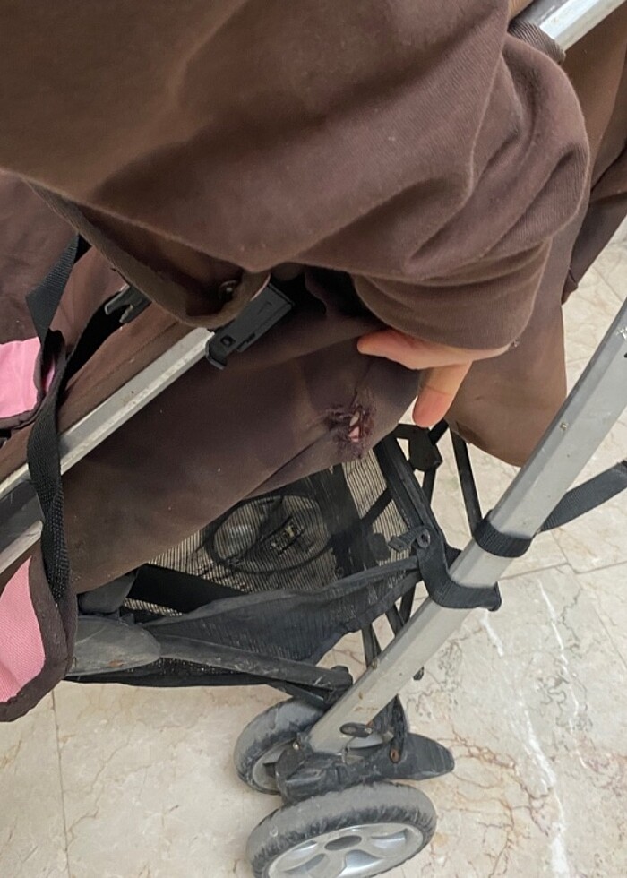 BASTON BEBEK ARABASI - Görsel 4