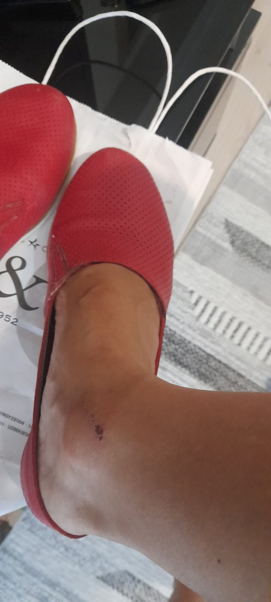 Kırmızı Deri Kadın Şort - Biker Stil - Görsel 2