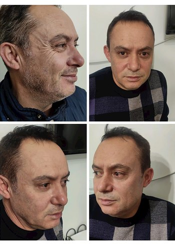  Beden Xaura 24K Anti-Aging ,kırışıklık için kullanılır.