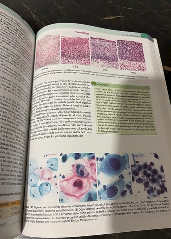 Robbins Temel Patoloji Kitabı - 10. Baskı - Görsel 6