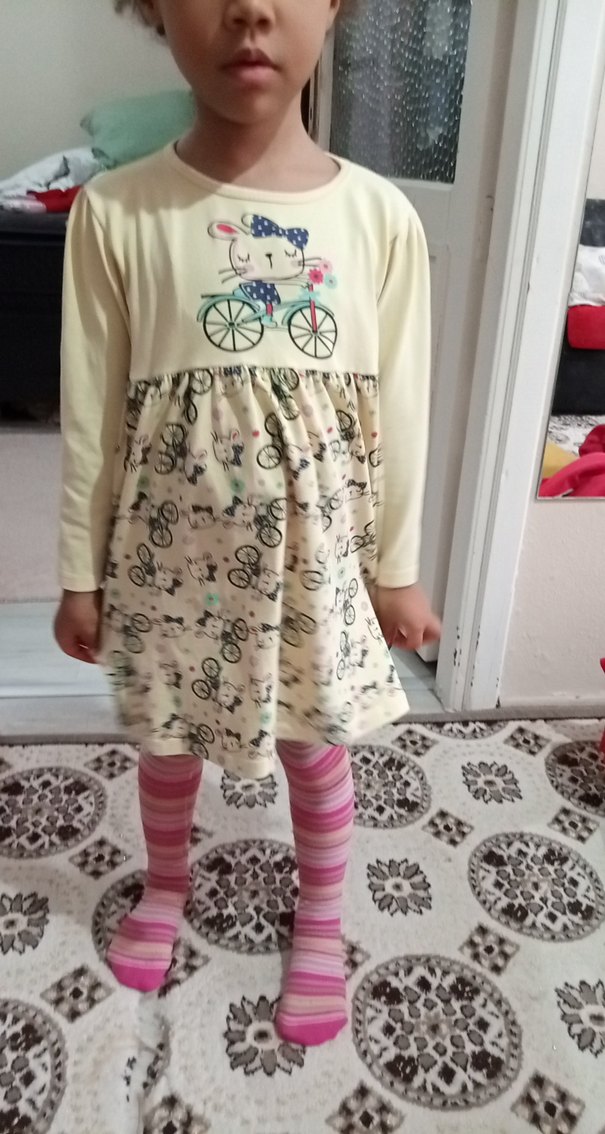 Çok Renkli Kız Çocuk Bisiklet Baskılı Elbise - Görsel 2