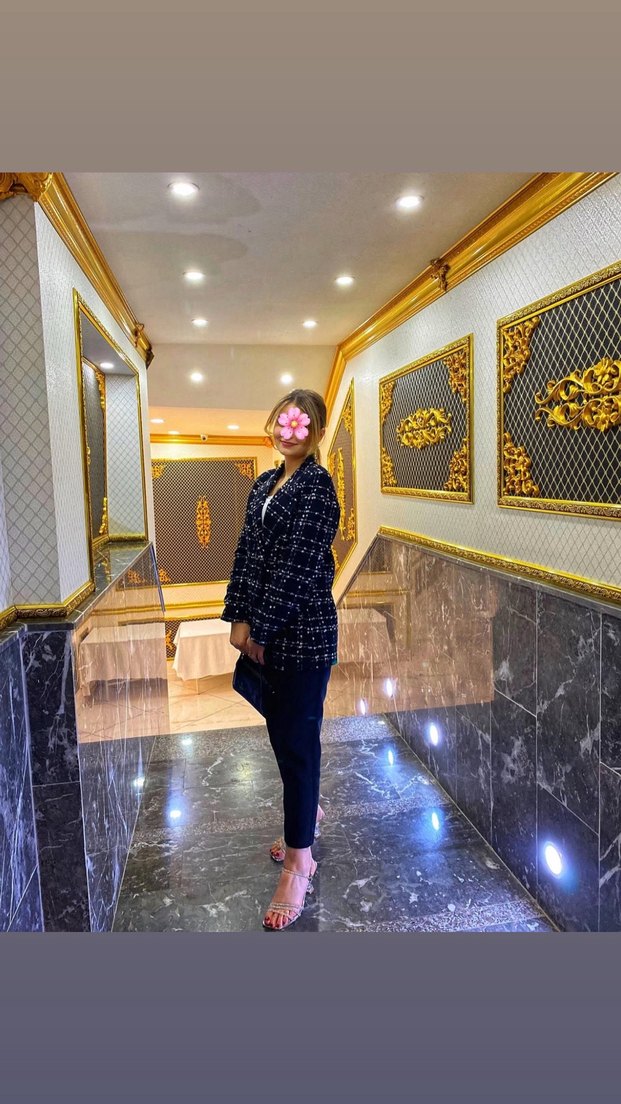 Düğmeli Siyah Kareli Midi Blazer - Görsel 5