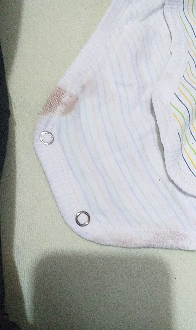 Uzun Kollu, Düğmeli Bebek Çıtçıtlı Body - Görsel 2