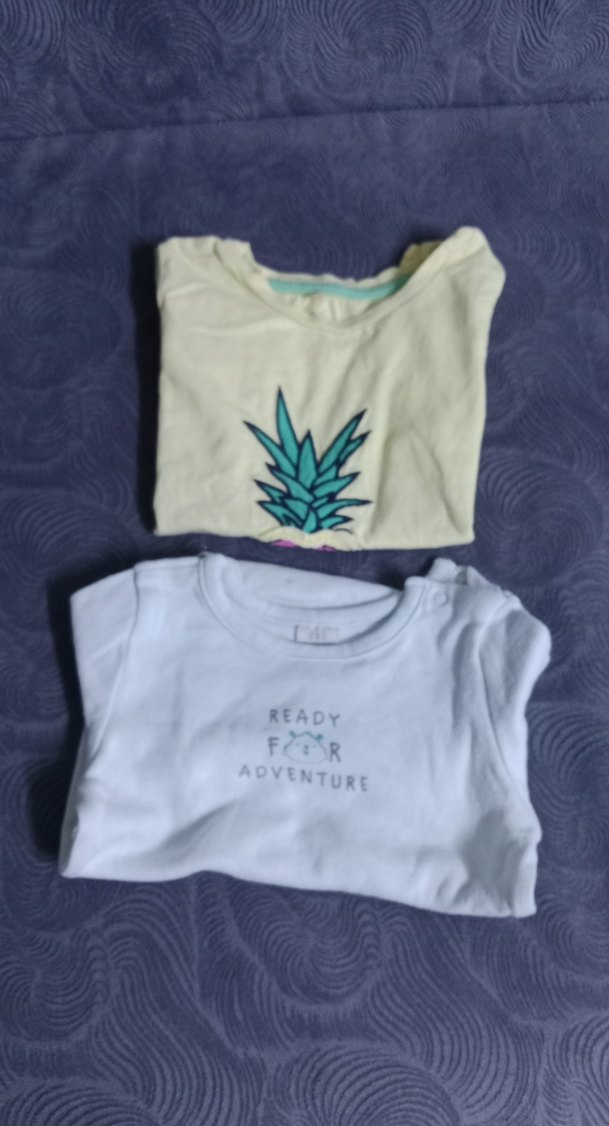 Sarı, Uzun Kollu, Düğmeli Erkek Bebek Body - Görsel 5