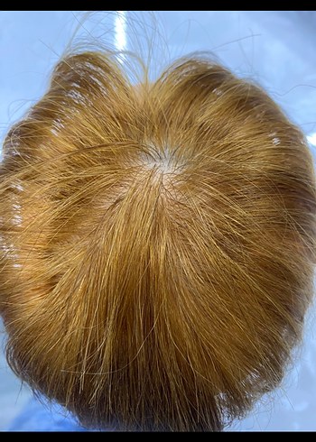 Tül tepelik gerçek saç - Görsel 5