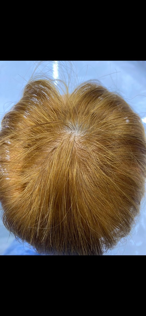 Tül tepelik gerçek saç - Görsel 5