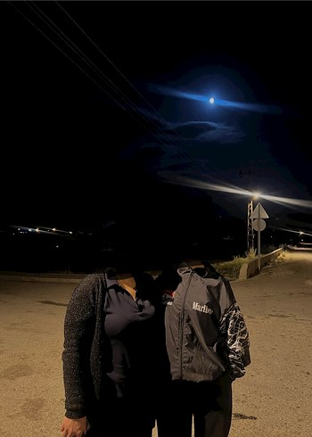 Siyah Baskılı Yağmurluk - Görsel 2