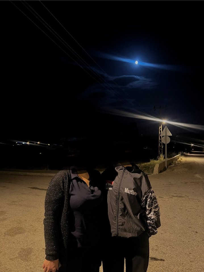 Siyah Baskılı Yağmurluk - Görsel 2