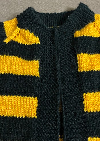 Erkek Çocuk Sarı-Siyah Çizgili Kısa Kollu yelek - Görsel 4