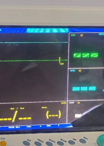 Beyaz CMS Monitör - Görsel 4