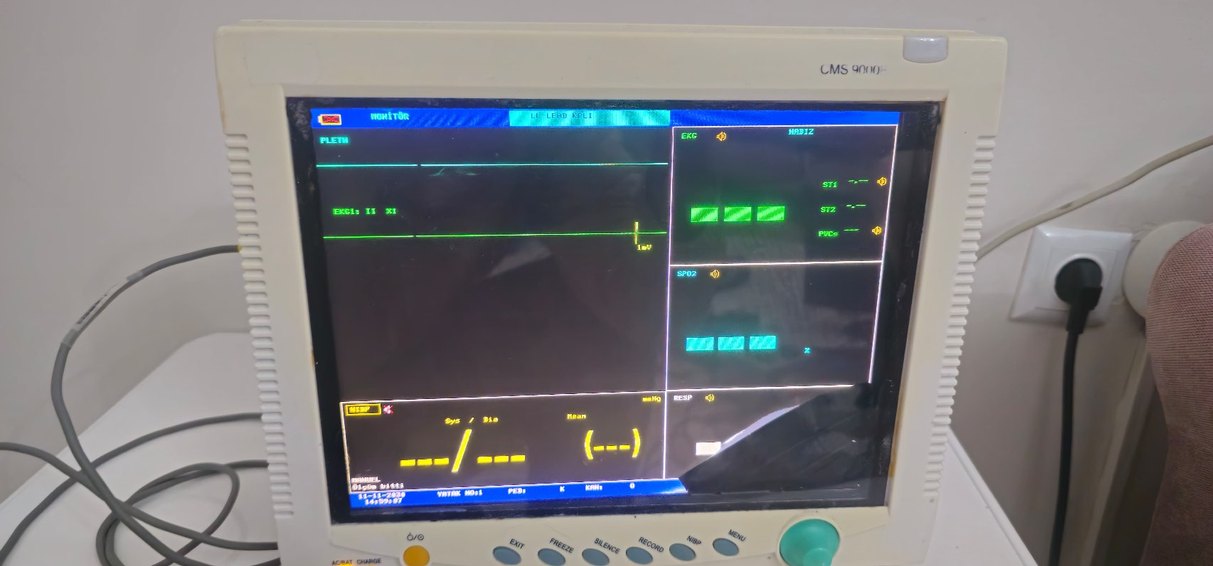 Beyaz CMS Monitör - Görsel 4