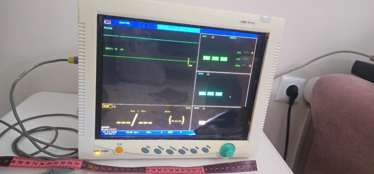 Beyaz CMS Monitör - Görsel 2