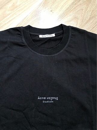 Acne oversize