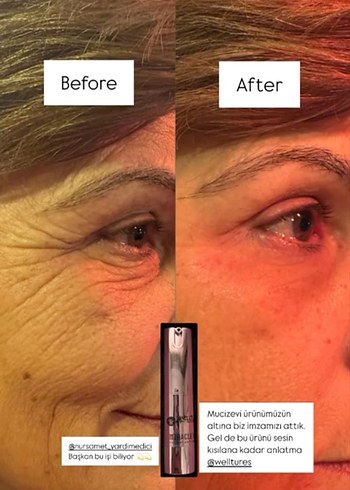 Welltures MiracleWell Anında Kırışıklık Karşıtı Serum - Görsel 6