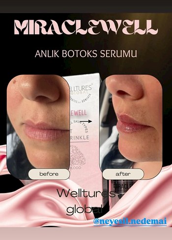 Welltures MiracleWell Anında Kırışıklık Karşıtı Serum - Görsel 5