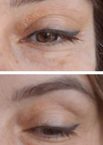 Welltures MiracleWell Anında Kırışıklık Karşıtı Serum - Görsel 2