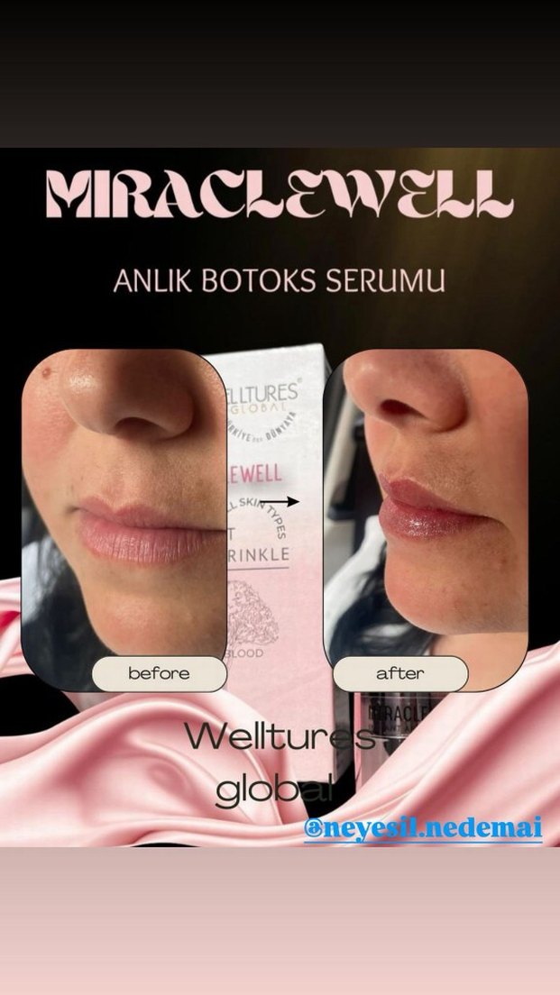 Welltures MiracleWell Anında Kırışıklık Karşıtı Serum - Görsel 5