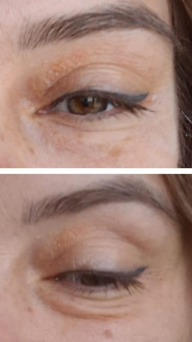 Welltures MiracleWell Anında Kırışıklık Karşıtı Serum - Görsel 2