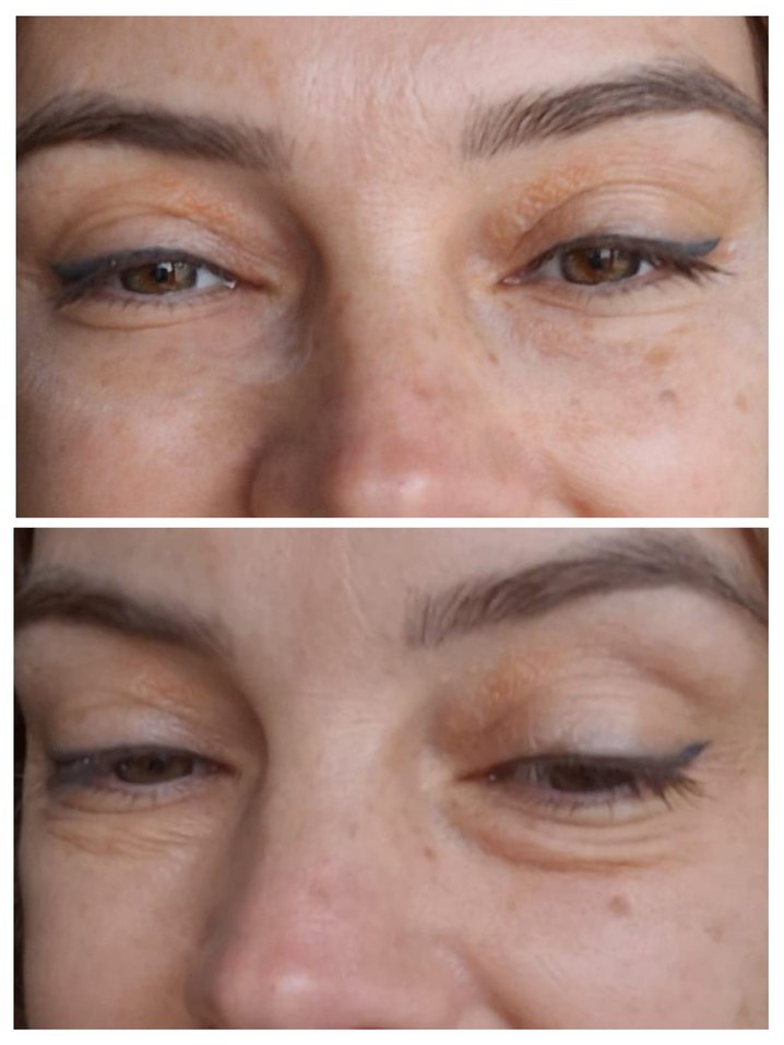 Welltures MiracleWell Anında Kırışıklık Karşıtı Serum - Görsel 3