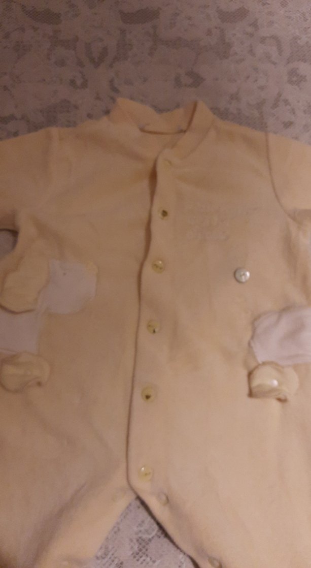 Düğmeli Bebek Hastane Tulumu - Görsel 3