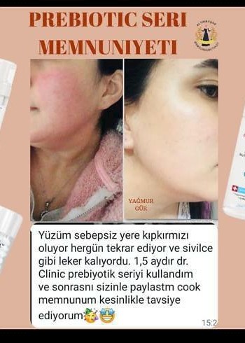 Prebiyotik Cilt Bakım Serisi Memnuniyeti
