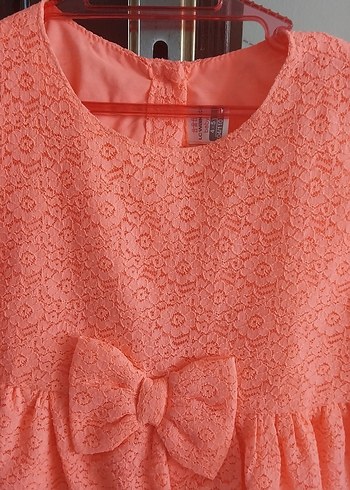 Dantel Detaylı Kolsuz Nar çiçeği Kız Elbisesi - Görsel 3