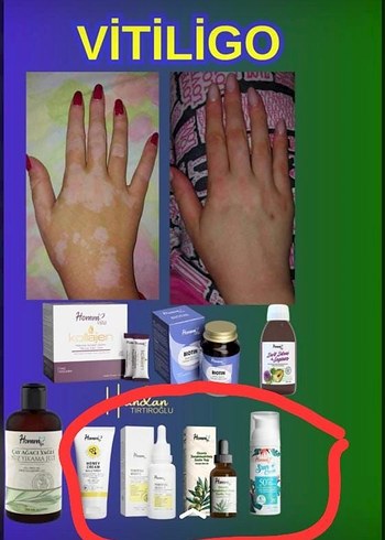 vücut spresi - Görsel 4