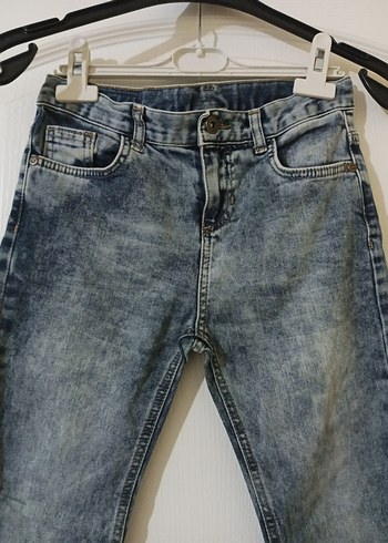 Erkek Çocuk Lacivert Gri Batik Desenli Denim Pantolon - Görsel 2