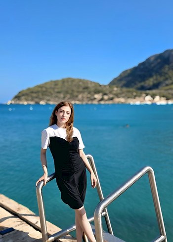 siyahbeyaz desenli elbise kısa - Görsel 2