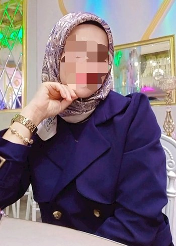 Bej Mini Kadın Etekli Takım Trençkot - Görsel 3