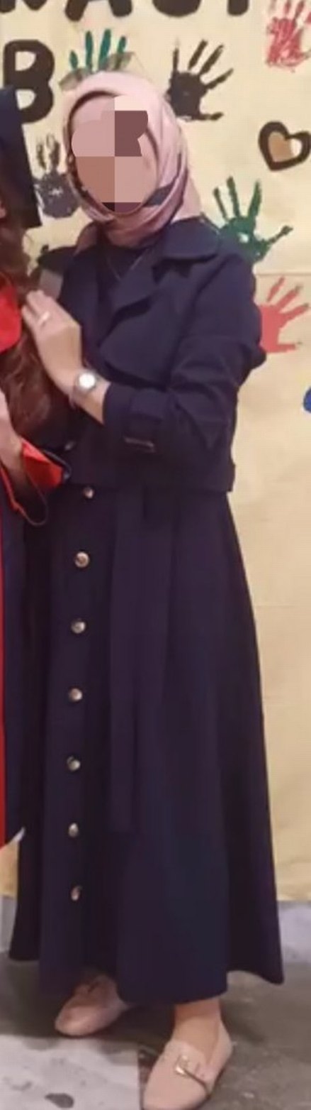 Bej Mini Kadın Etekli Takım Trençkot - Görsel 2