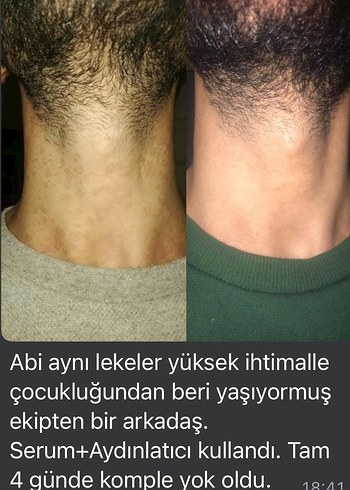 Akne İzleri İçin Cilt Bakım Ürünü serum 900 tl - Görsel 7