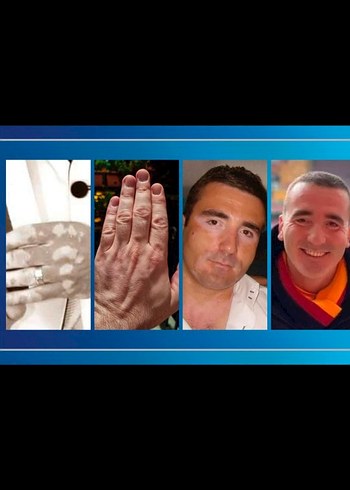 Akne İzleri İçin Cilt Bakım Ürünü serum 900 tl - Görsel 4