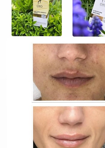 Akne İzleri İçin Cilt Bakım Ürünü serum 900 tl - Görsel 5