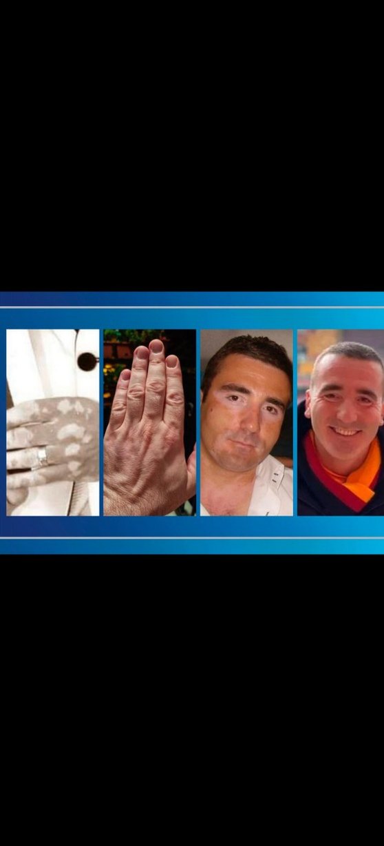 Akne İzleri İçin Cilt Bakım Ürünü serum 900 tl - Görsel 4