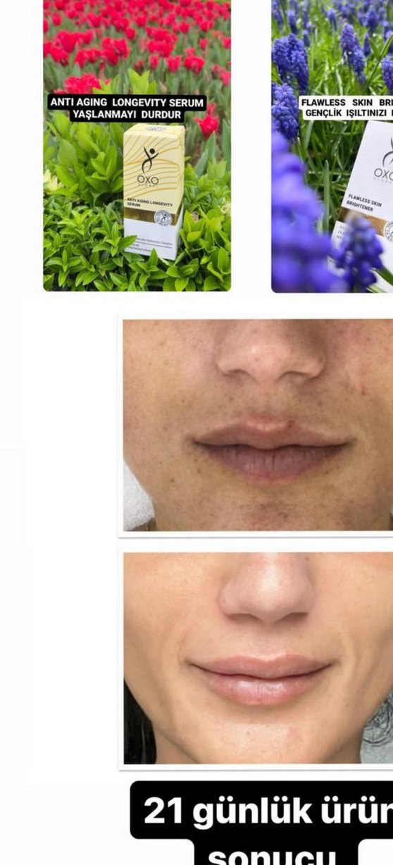 Akne İzleri İçin Cilt Bakım Ürünü serum 900 tl - Görsel 5