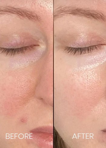 Luis Bien C Vitamini Serum 30ml - Görsel 3