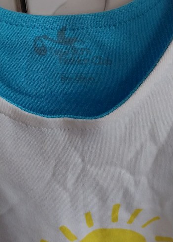 Mavi Baskılı Bebek Atlet Body - Görsel 2