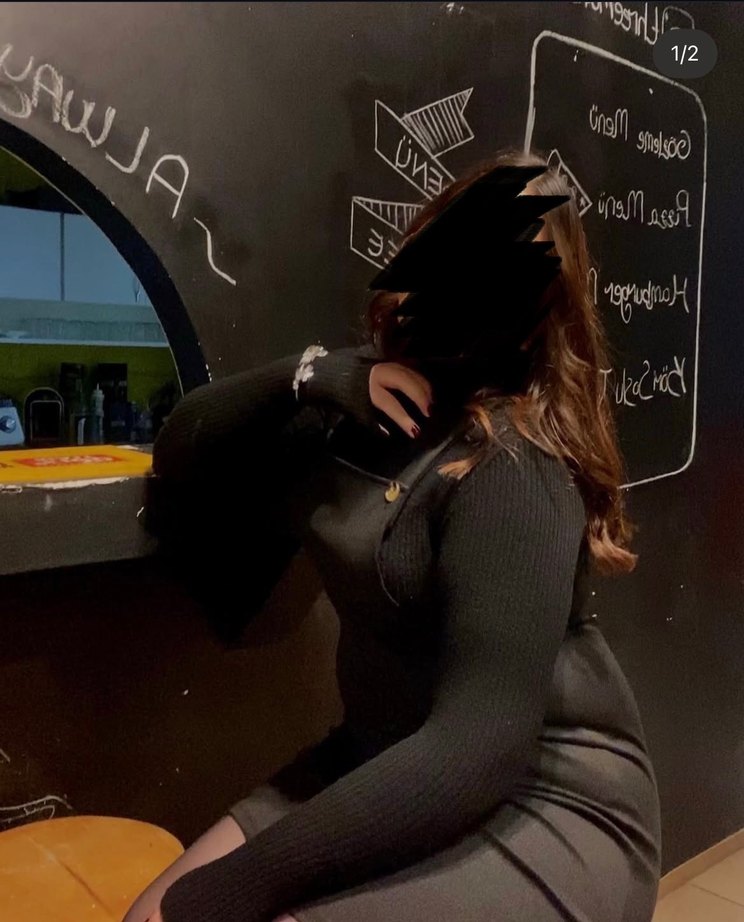 Kadın Siyah DÜĞME ASKILI Detaylı Elbise - Görsel 2