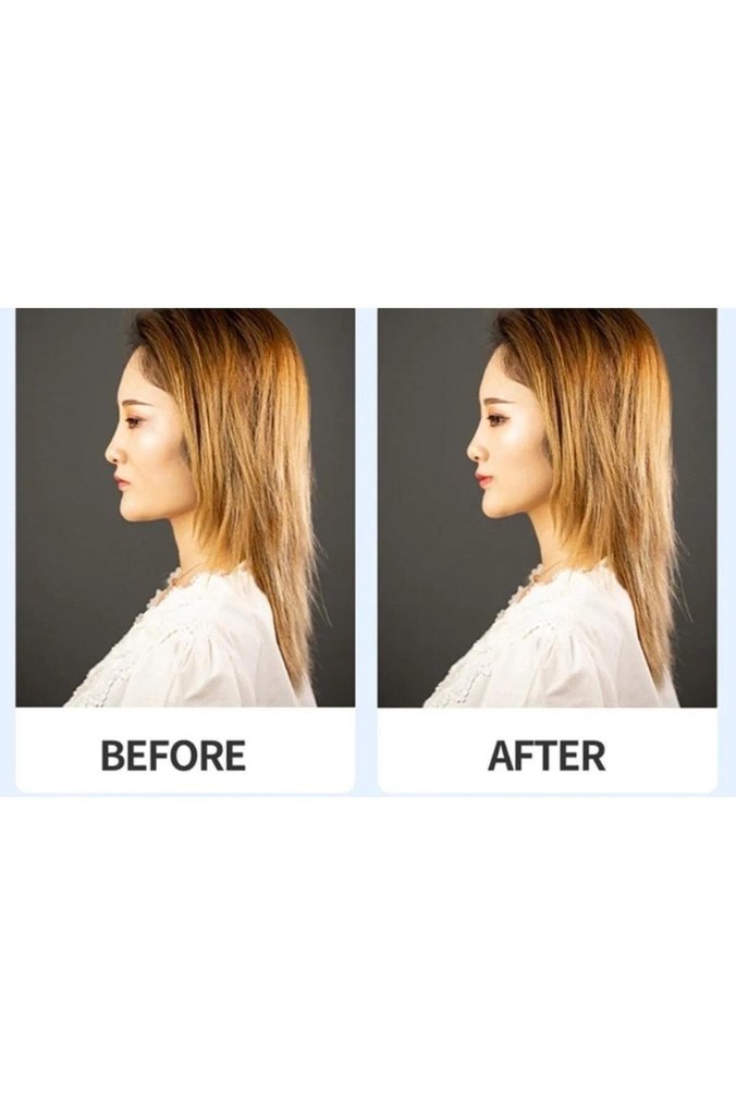 Kaş Germe Göz Germe Yüz Gerdirme İpli Toka Çekik Göz - Görsel 3