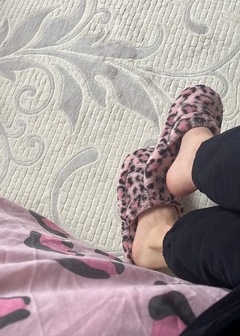 Pembe Zebra Desenli Tüylü Kadın Terlik - Görsel 2