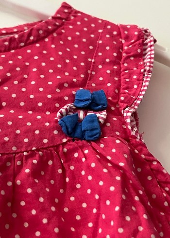 Kolsuz sırt Düğmeli Kız Çocuk Elbise - Görsel 2